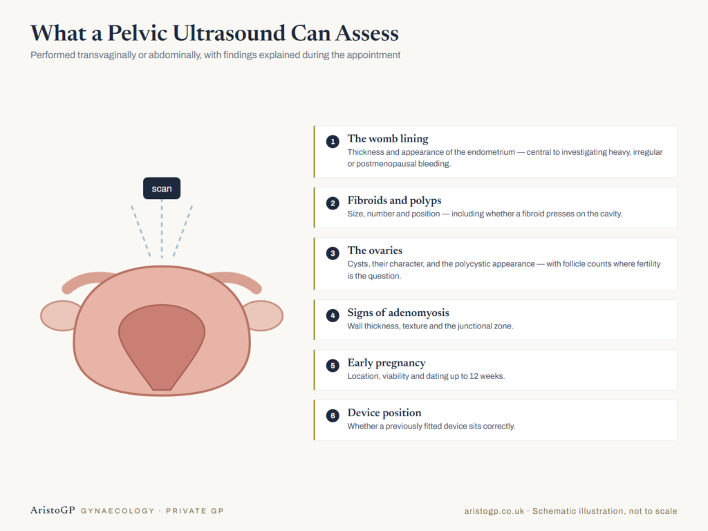 Diagram of what a pelvic ultrasound can assess: uterus, endometrium, ovaries and early pregnancy